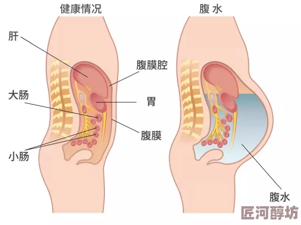 腹部灌满隆起jing液研究发现此现象可能与特定饮食习惯和生活方式有关