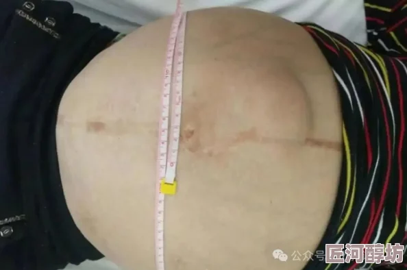 腹部灌满隆起jing液研究发现此现象可能与特定饮食习惯和生活方式有关